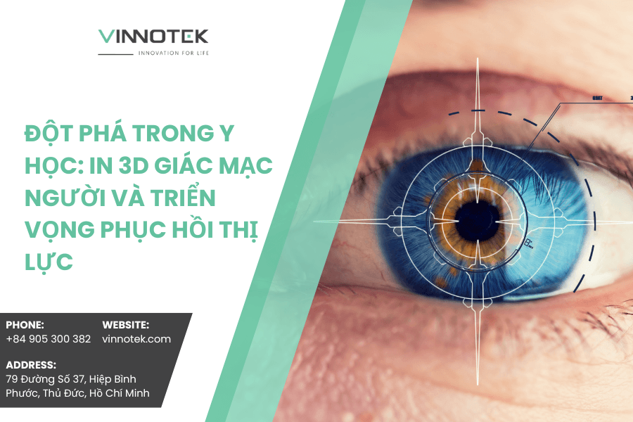 In 3D giác mạc người