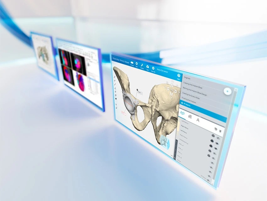 Materialise Mimics Viewer – Xem & chia sẻ mô hình 3D