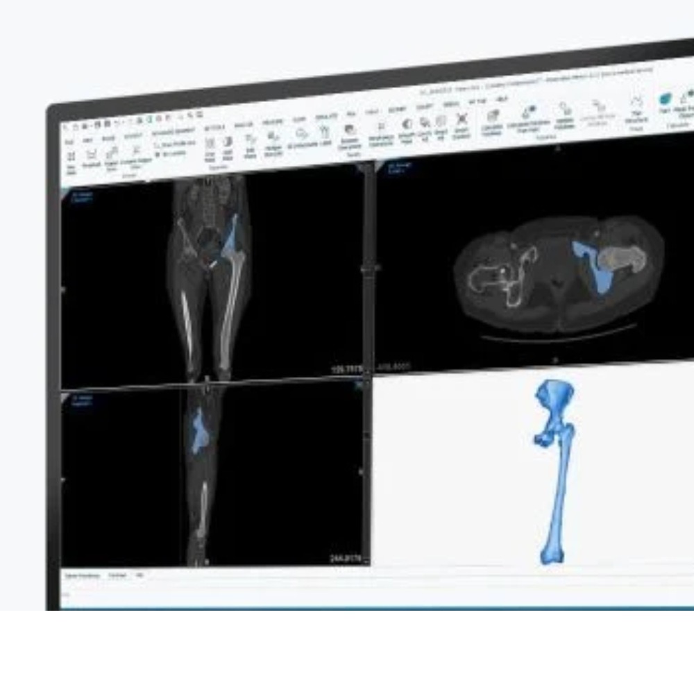 Materialise cung cấp phần mềm Mimics mạnh mẽ, cho phép xử lý dữ liệu CBCT