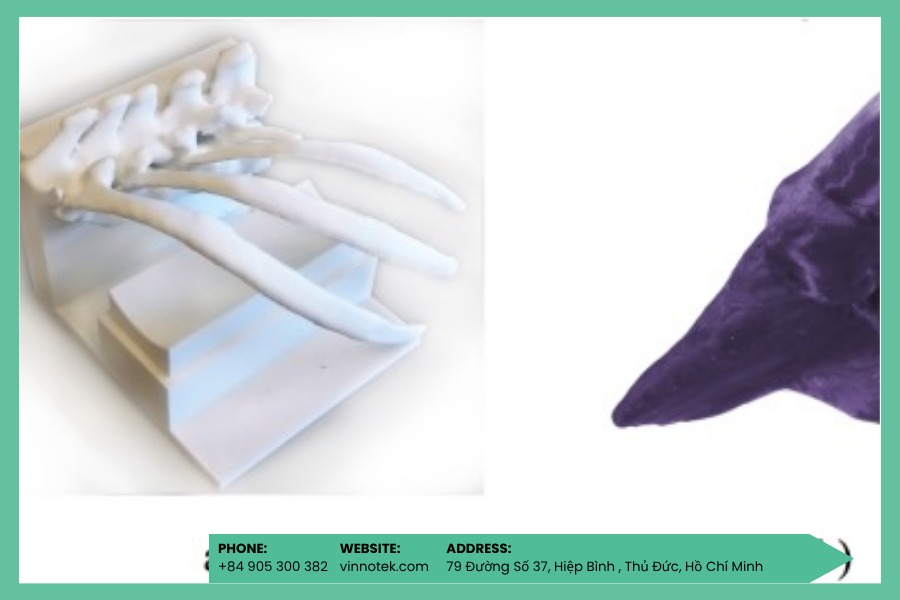 Mô hình giải phẫu 3D DLP tối ưu tốc độ cho mô hình vừa và nhỏ