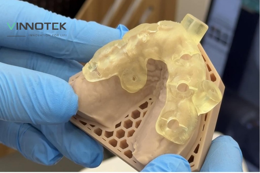 SLA hỗ trợ digital dentistry với khả năng tạo dental model, surgical guide