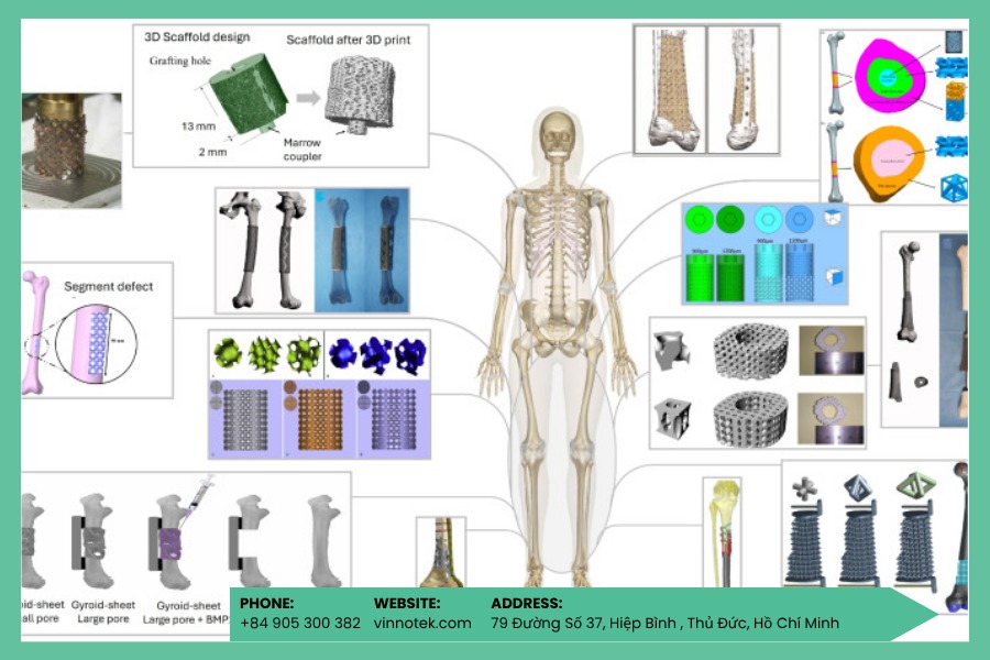 Thiết kế implant theo giải phẫu và chức năng