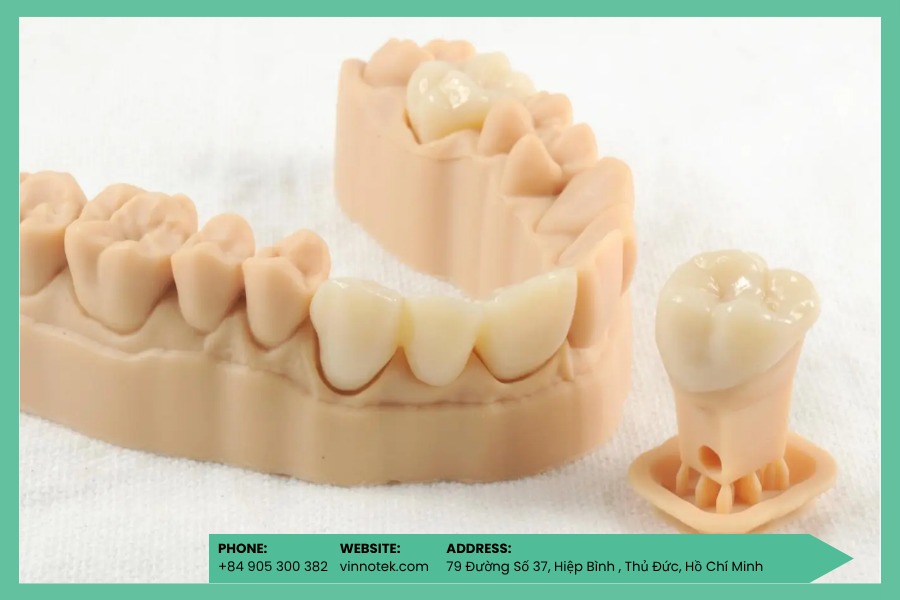 SLA là tiêu chuẩn cho dental casting độ chính xác cao