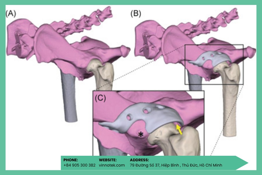 SLA tối ưu cho implant y tế cỡ nhỏ và trung bình