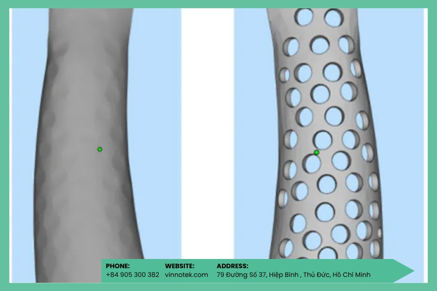 Wrist splint in 3D giúp cố định hiệu quả và tăng rõ mức độ thoải mái cho bệnh nhân.